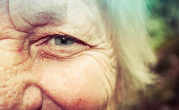 découvrez ce qu'est l'aging, ses causes, ses effets sur le corps et l'esprit, ainsi que des conseils pratiques pour vieillir en santé et ralentir les signes du temps.