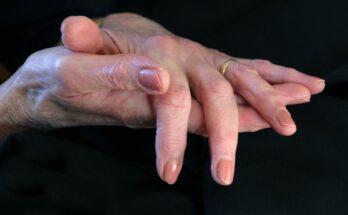découvrez ce qu'est la polyarthrite rhumatoïde, ses causes, symptômes, traitements, et les conseils pour mieux vivre avec cette maladie inflammatoire chronique des articulations.
